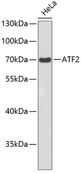 ATF2 Rabbit Polyclonal Antibody - Image 2