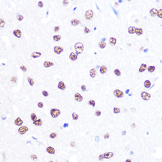 ATF2 Rabbit Polyclonal Antibody - Image 3