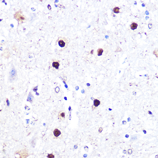 ATF2 Rabbit Polyclonal Antibody - Image 4