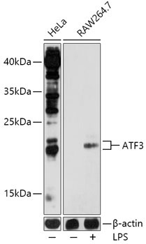 ATF3 Rabbit Polyclonal Antibody