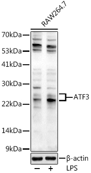 ATF3 Rabbit Polyclonal Antibody - Image 3