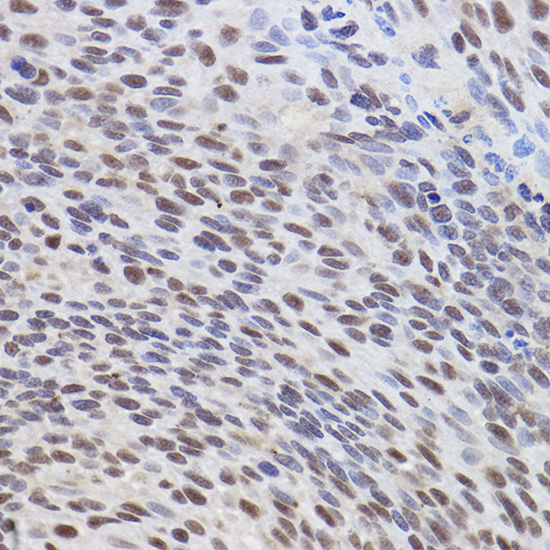 ATF3 Rabbit Polyclonal Antibody - Image 4