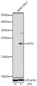 ATF3 Rabbit Polyclonal Antibody