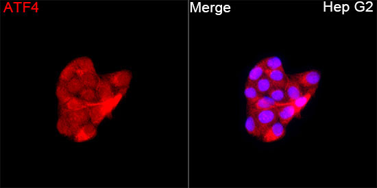 ATF4 Rabbit Polyclonal Antibody - Image 2