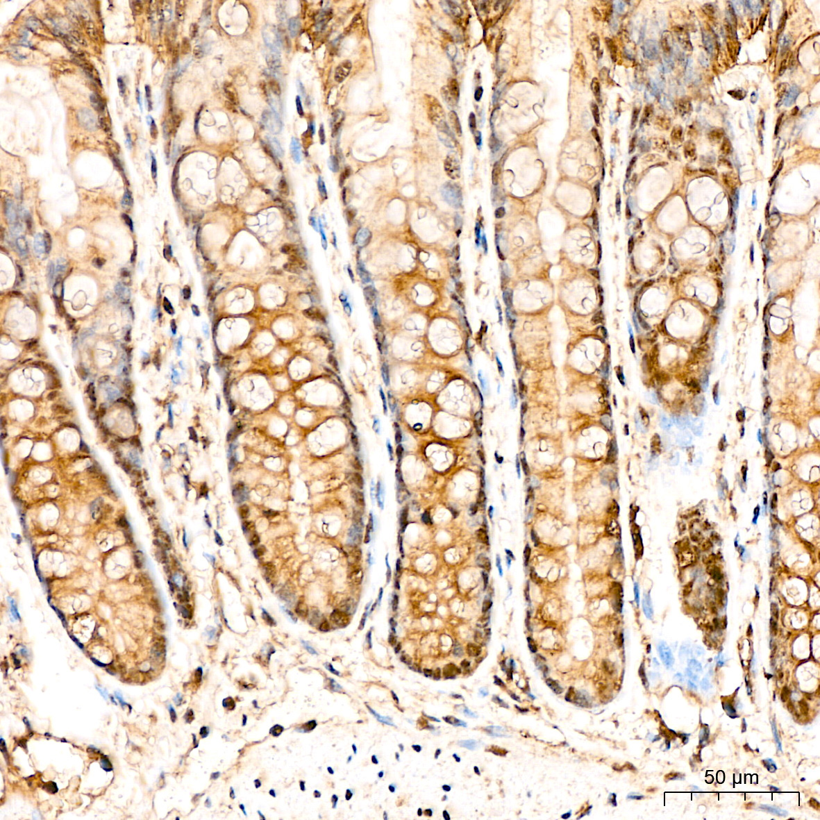 ATF4 Rabbit Polyclonal Antibody - Image 2