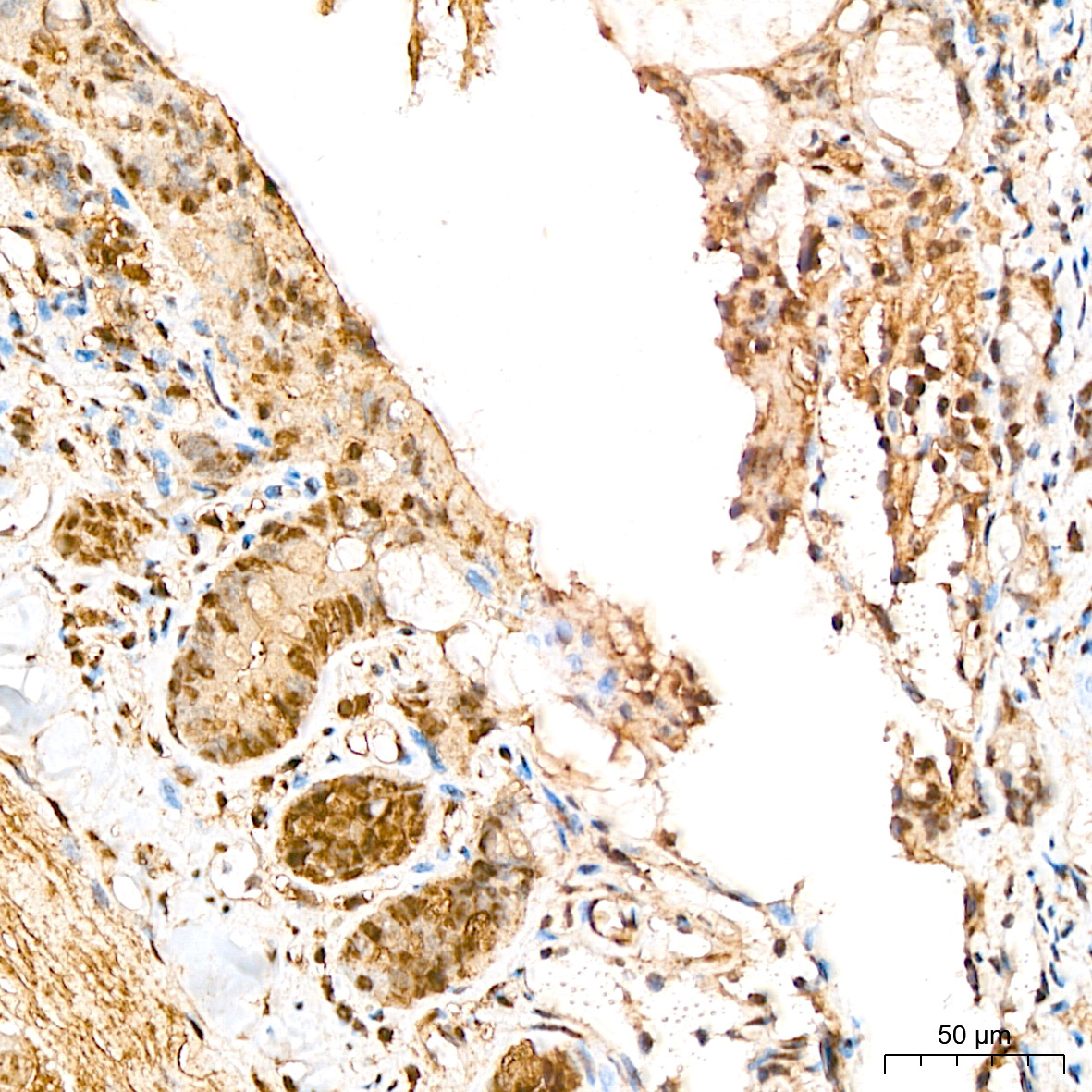 ATF4 Rabbit Polyclonal Antibody - Image 3