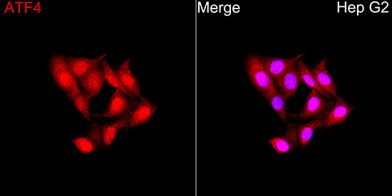 ATF4 Rabbit Polyclonal Antibody - Image 4