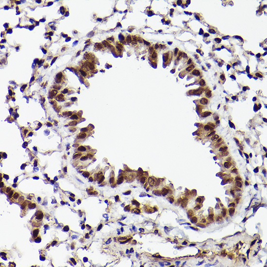 ATF5 Rabbit Polyclonal Antibody - Image 2