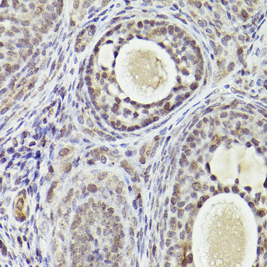 ATF5 Rabbit Polyclonal Antibody - Image 3