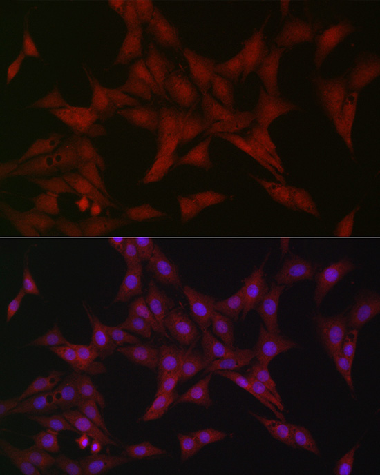 ATF5 Rabbit Polyclonal Antibody - Image 4