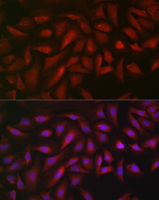 ATF5 Rabbit Polyclonal Antibody - Image 5