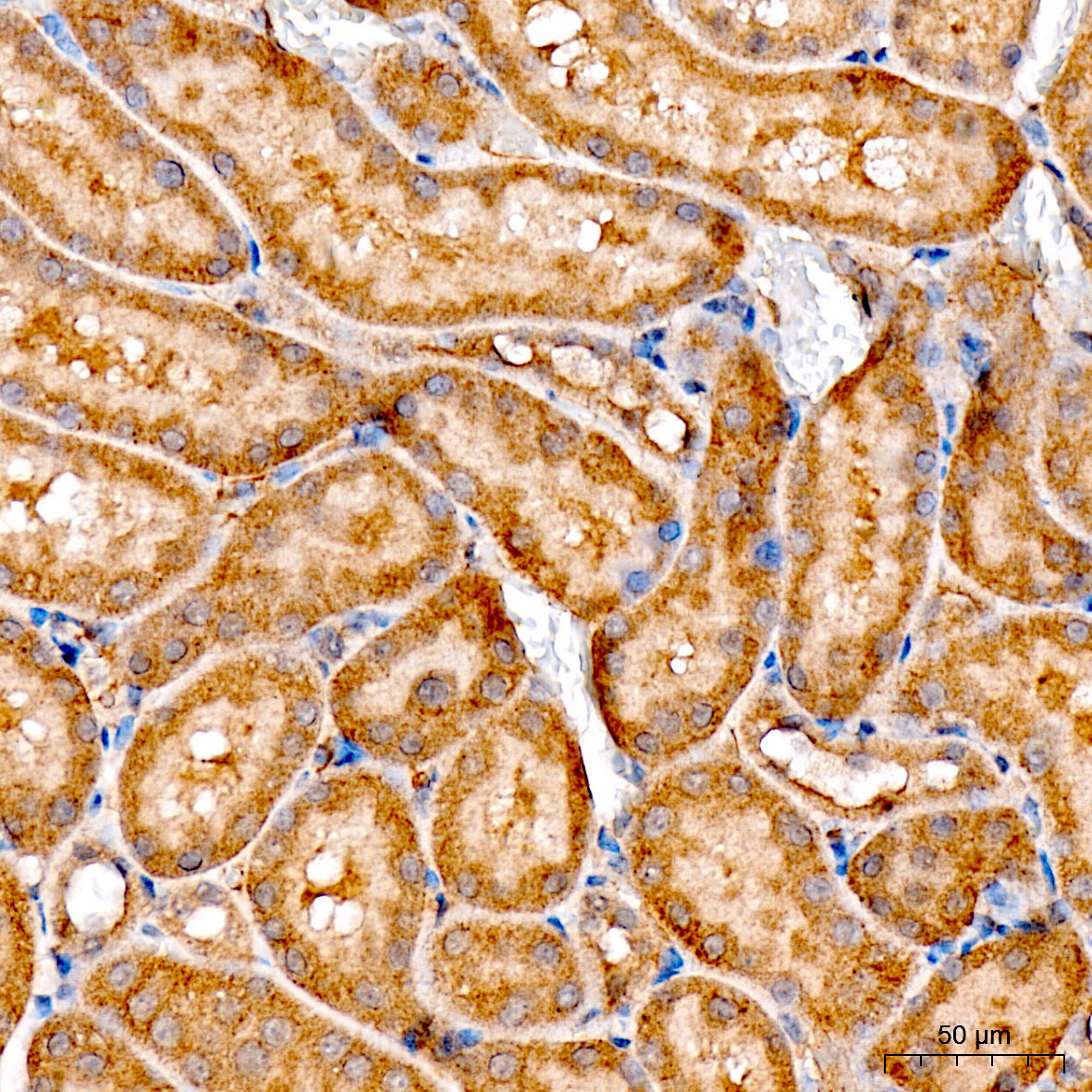 ATF6 Rabbit Polyclonal Antibody - Image 2