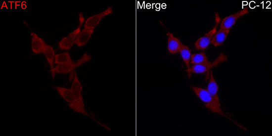 ATF6 Rabbit Polyclonal Antibody - Image 5