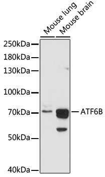 ATF6B Rabbit Polyclonal Antibody