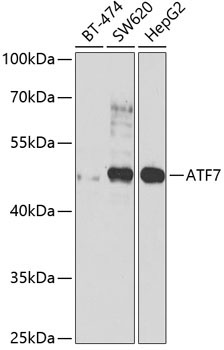 ATF7 Rabbit Polyclonal Antibody