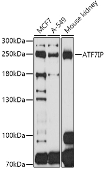 ATF7IP Rabbit Polyclonal Antibody