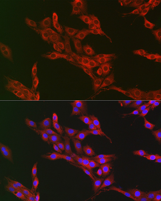 ATG12 Rabbit Polyclonal Antibody - Image 3