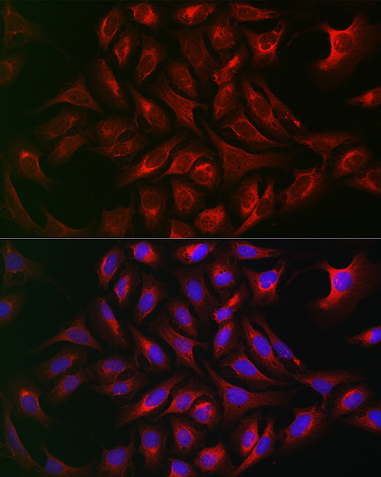 ATG12 Rabbit Polyclonal Antibody - Image 4