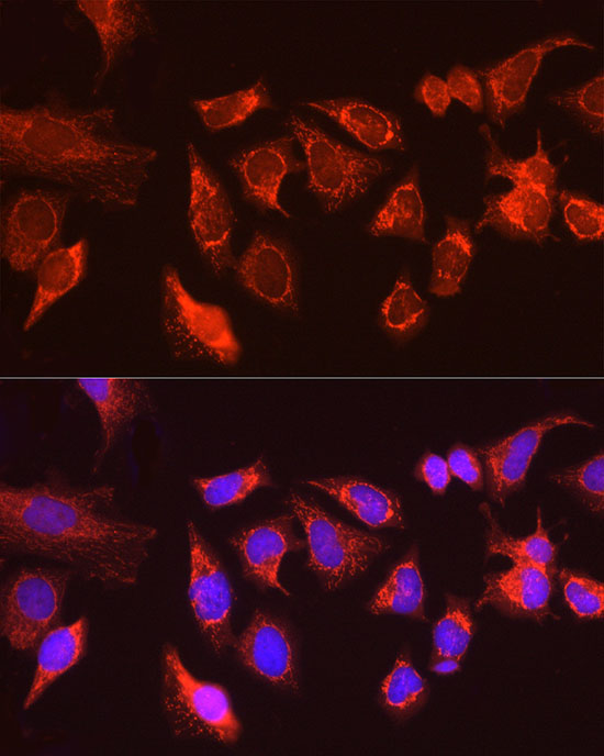 ATG13 Rabbit Polyclonal Antibody - Image 3