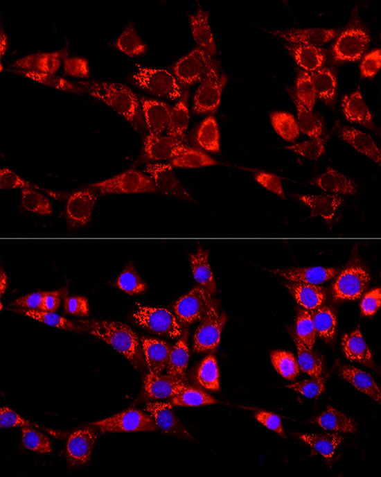 ATG13 Rabbit Polyclonal Antibody - Image 4