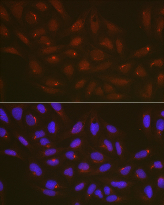 ATG14 Rabbit Polyclonal Antibody - Image 3