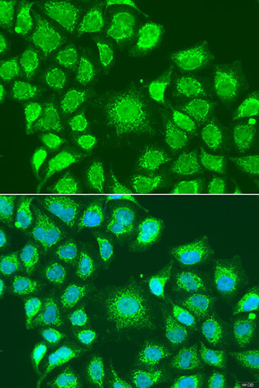 ATG4D Rabbit Polyclonal Antibody - Image 2