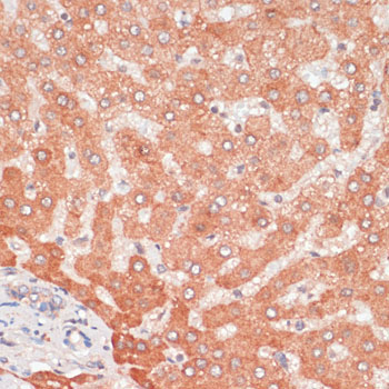 ATG5 Rabbit Polyclonal Antibody - Image 2