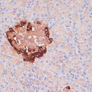 ATG5 Rabbit Polyclonal Antibody - Image 3