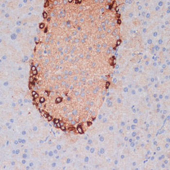 ATG5 Rabbit Polyclonal Antibody - Image 4