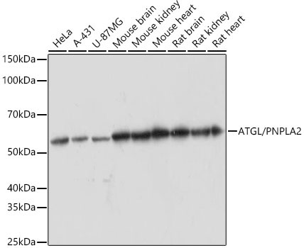 ATGL/PNPLA2 Rabbit Monoclonal Antibody