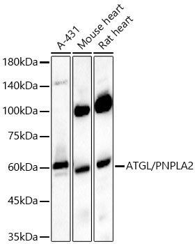 ATGL/PNPLA2 Rabbit Polyclonal Antibody