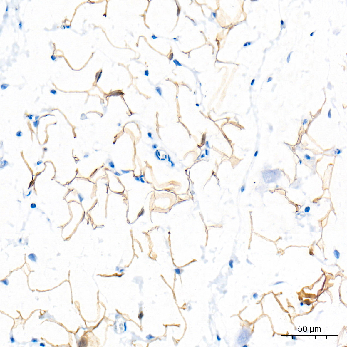 ATGL/PNPLA2 Rabbit Polyclonal Antibody - Image 2