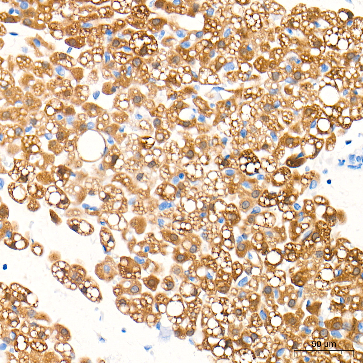 ATGL/PNPLA2 Rabbit Polyclonal Antibody - Image 3