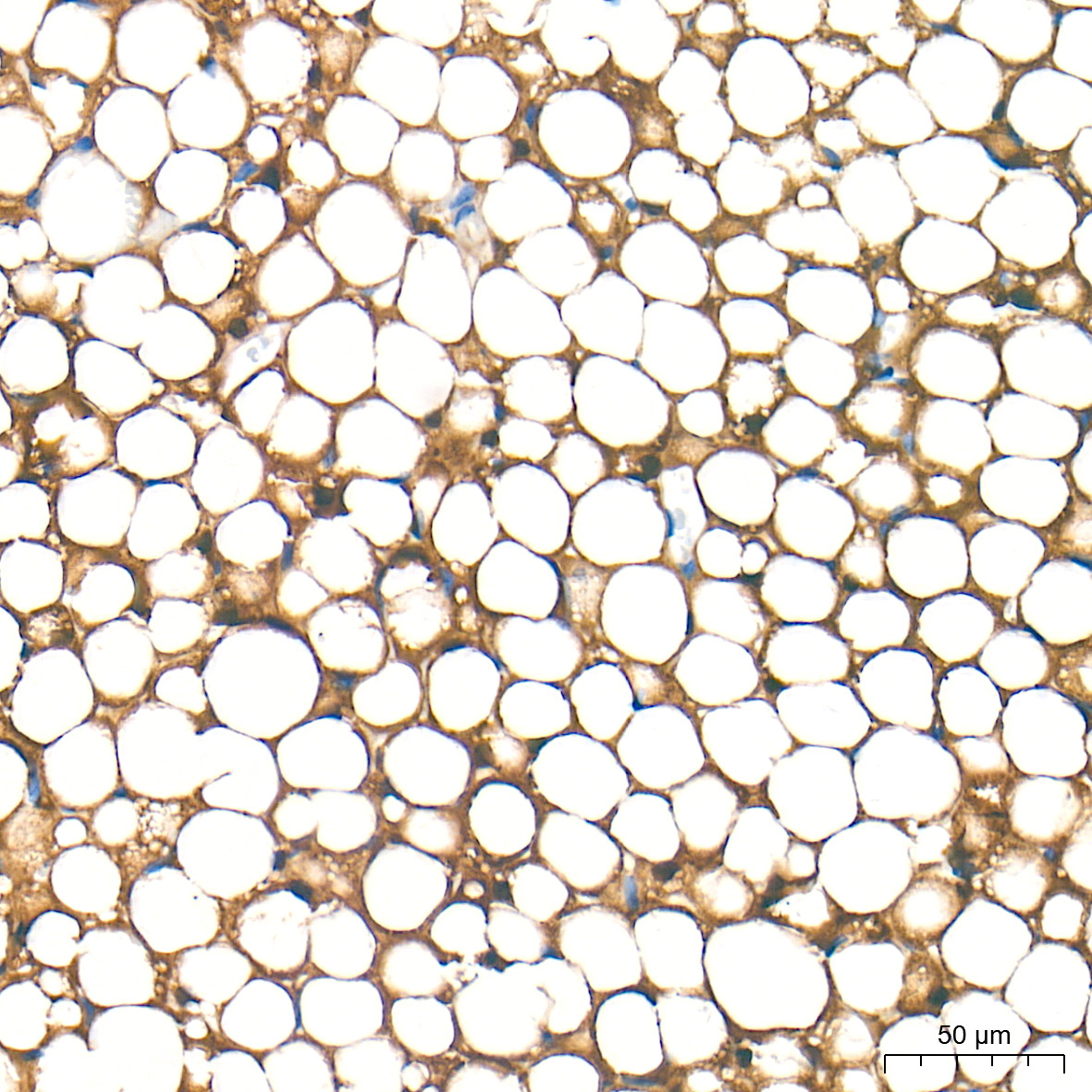 ATGL/PNPLA2 Rabbit Polyclonal Antibody - Image 4