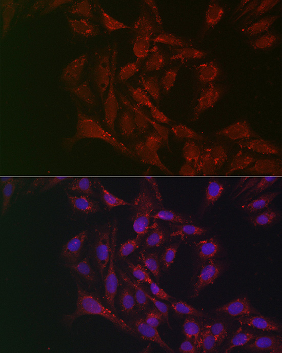 ATGL/PNPLA2 Rabbit Polyclonal Antibody - Image 5
