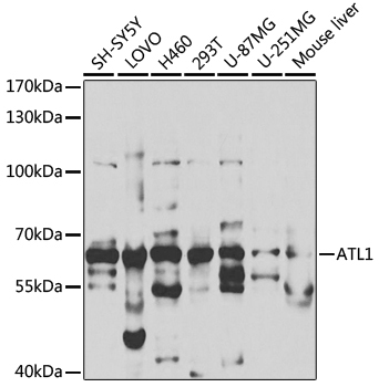 ATL1 Rabbit Polyclonal Antibody