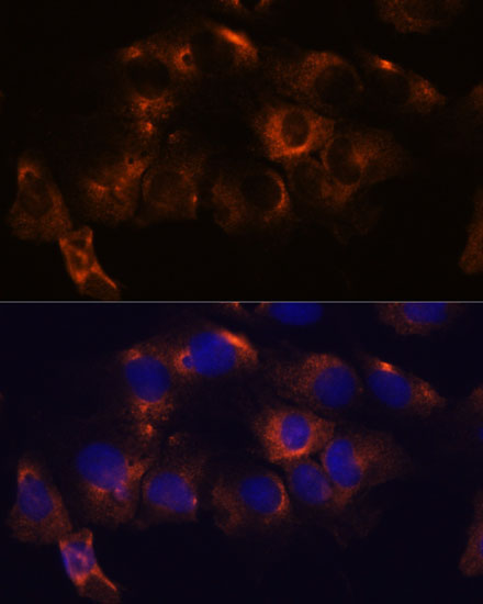 ATL2 Rabbit Polyclonal Antibody - Image 2