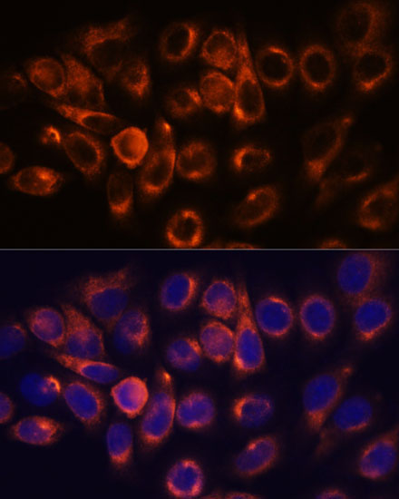ATL2 Rabbit Polyclonal Antibody - Image 3