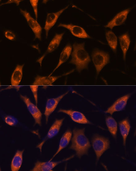 ATL2 Rabbit Polyclonal Antibody - Image 4