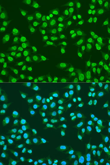 ATM Rabbit Polyclonal Antibody