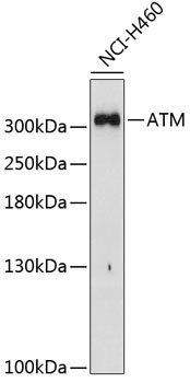 ATM Rabbit Polyclonal Antibody