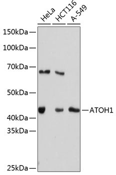ATOH1 Rabbit Monoclonal Antibody