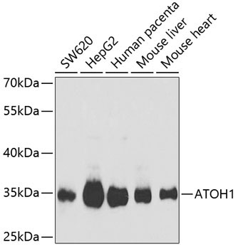 ATOH1 Rabbit Polyclonal Antibody
