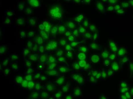 ATOH7 Rabbit Polyclonal Antibody