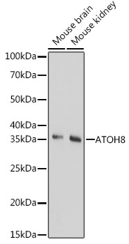 ATOH8 Rabbit Polyclonal Antibody