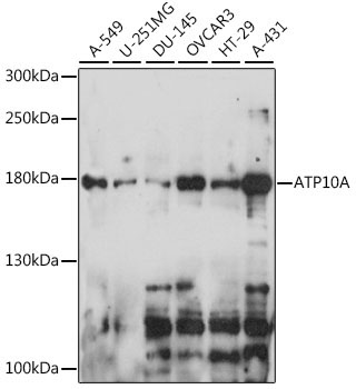 ATP10A Rabbit Polyclonal Antibody