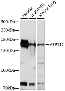 ATP11C Rabbit Polyclonal Antibody