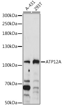 ATP12A Rabbit Polyclonal Antibody