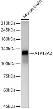 ATP13A2 Rabbit Polyclonal Antibody
