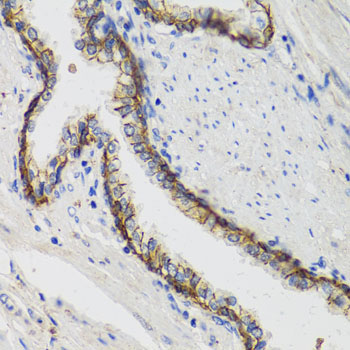 ATP1A Rabbit Polyclonal Antibody - Image 3